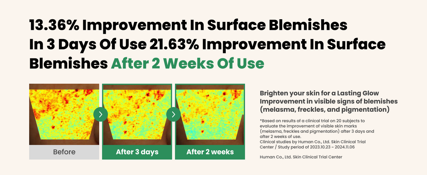 AXIS-Y Dark Spot Correcting Glow